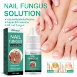 Nail Fungus Solution - Image 3
