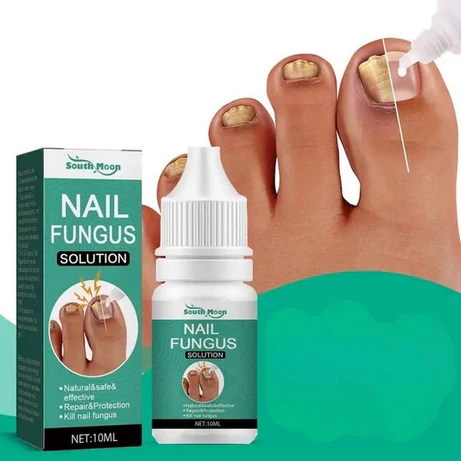 NailFungusSolution02 Nail Fungus Solution - Image 1